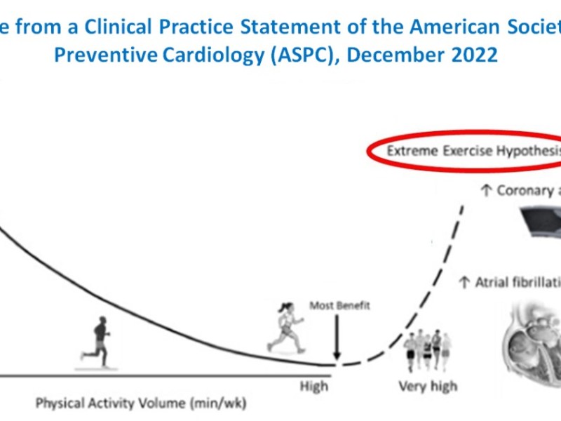 Yikes, I have a High Coronary Artery Calcification (CAC) Score. Was it Caused by Running? Will Running Make Things&nbsp;Worse?